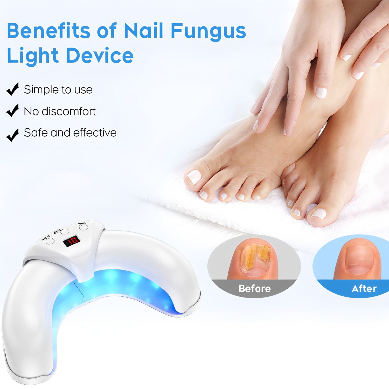 진균 레이저 치료기 손톱 진균증 치료 효과적으로 손톱  - Industrial Laser Removal 리뷰 및 가격